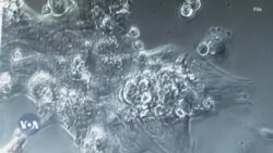 Jaarmayaan Fayyaa Addunyaa Dhukkubni Kaanserii Dabalaa Deemuu fi Zaambiyaa Keesstti Amaleeffannaan Dhugaatii Alkoolii Hammaachuu Gabaase 