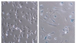 Quiz - Researchers: Exercise Best Tool Against Aging