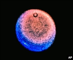 In this image provided by NASA, this false-color Voyager picture of Uranus shows a discrete cloud seen a bright streak near the planet's limb. (AP Photo/NASA)