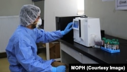 ښاغلي علیزي وویل چې تیره اونۍ د افغانستان په ۱۱ ولایتونو کې د کرونا ویروس د نوې بڼې ۲۰۷ مثبتې پېښې هم ثبت شوي دي.