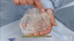 走进美国：神奇的3维立体打印心脏