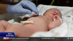 Shqetësimet për abortet në Shqipëri